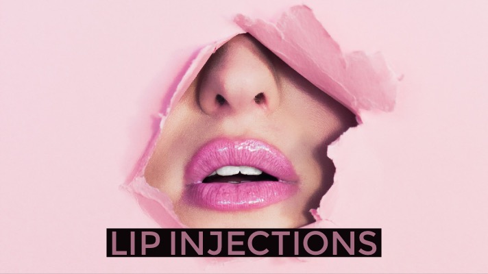 I Got Lip Injections – Everything You Need To Know!